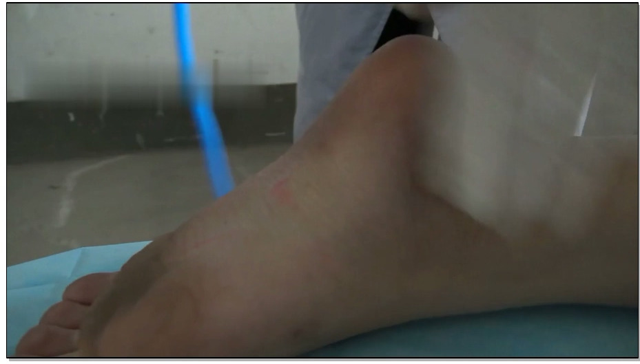 【梨花雨】秦彤之死