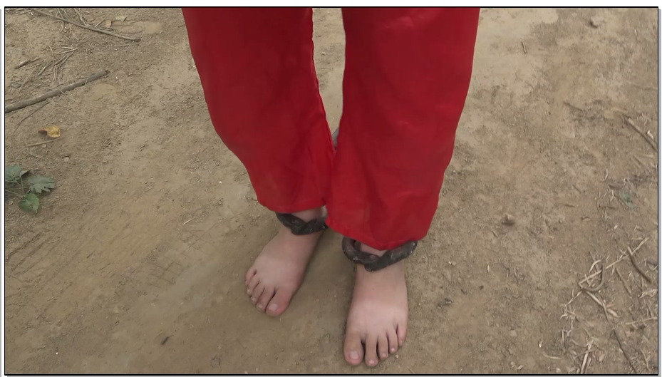 【梨花雨】毒妇